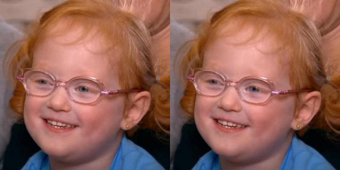 What Is Nystagmus? Everything To Know About Hazel Busby's Eye Condition On 'Outdaughtered'