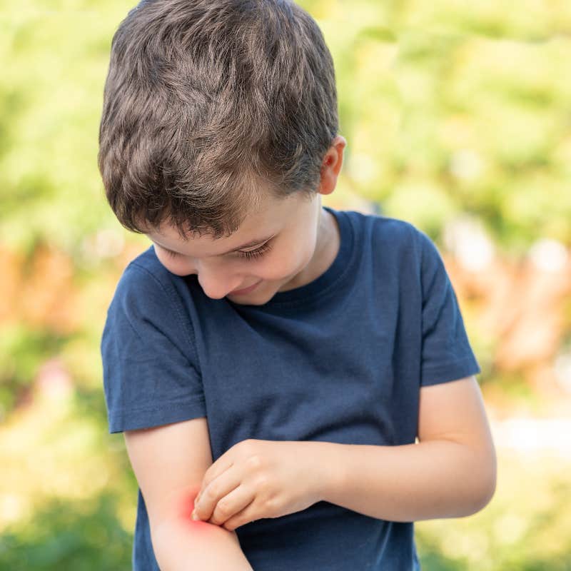 child scratching rash on arm