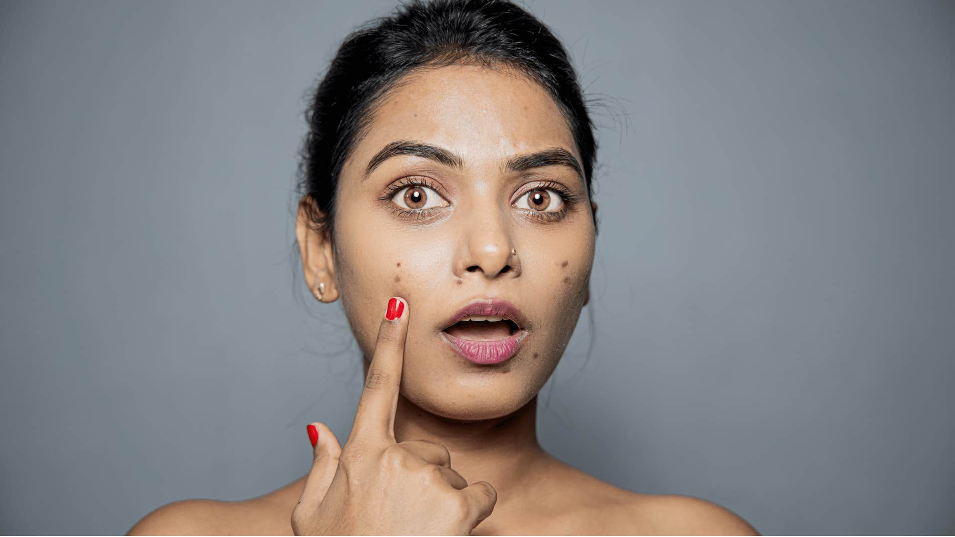 Woman pointing at acne