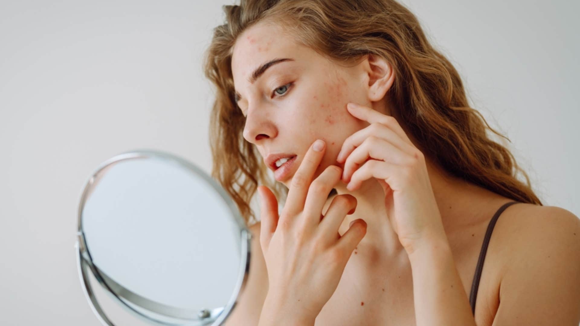 woman looking at acne on her face