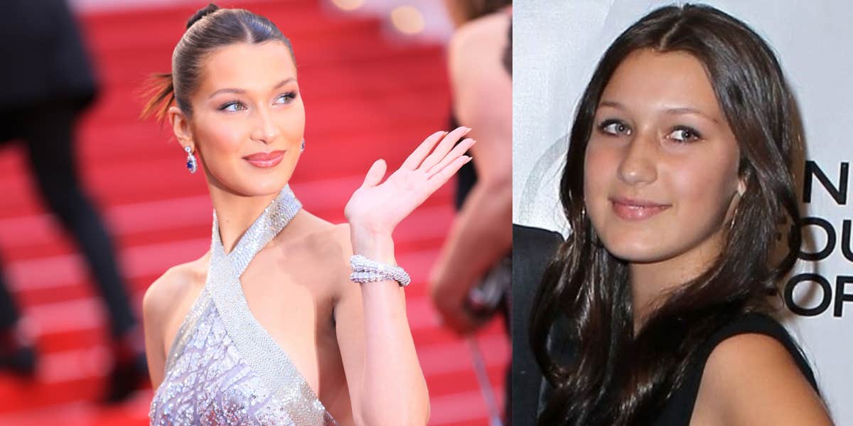 Bella Hadid Then & Now: See How Much Her Face Has Changed Over The