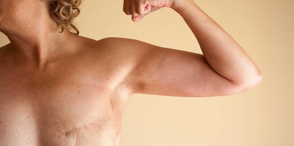 Mastectomy & Self Love: How Losing My Breasts Helped Me Love My