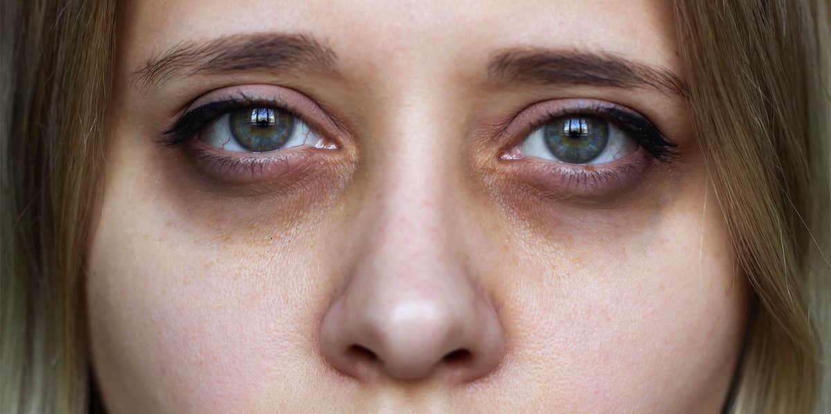 A Beauty Expert Tells Us The Secret To Cover Under Eye Bags And