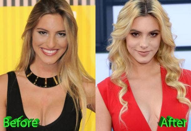 610px x 419px - Did Lele Pons Get Plastic Surgery? Before/After Photos And Details About  Her Nose Job | YourTango