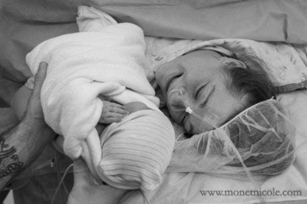 3 Truths About C Section Moms That Need To Be Said Out Loud - 7