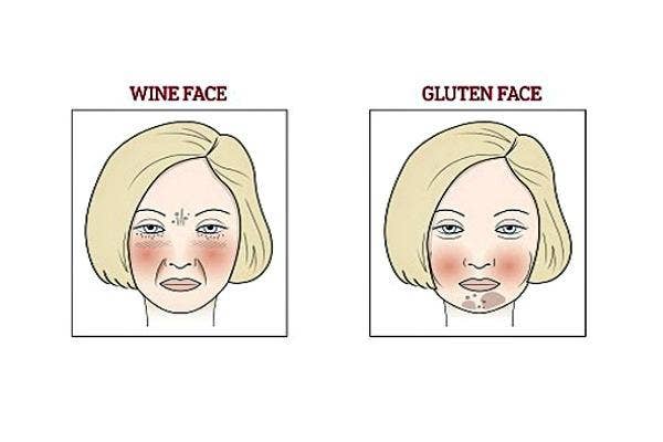 How To Know If You Have A Sugar  Gluten  Dairy Or Wine Face  According To A Naturopathic Doctor  - 69